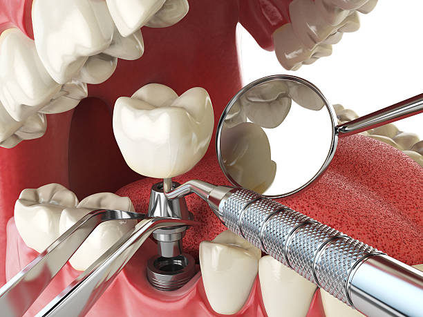 Best Emergency Denture Repair in Afton, WY