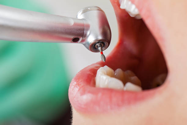 Best Cosmetic Emergency Dentistry in Afton, WY